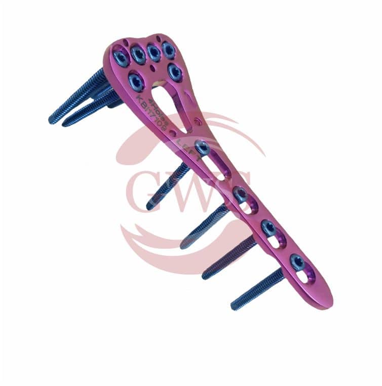 2.4mm Distal Radius Variable Angled (Double Column) Locking Plate Left/Right